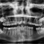 zobni rentgen